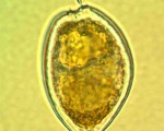 什么是东海原甲藻？