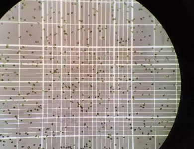 利用血球计数板计算藻细胞密度数量