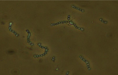 聚球藻属蓝细菌的物种多样性分析