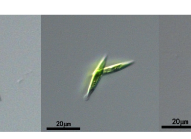 纤维藻属(GY-D31 Ankistrodesmus sp.)