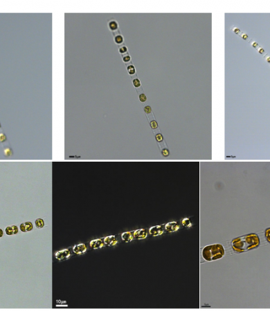 中肋骨条藻(GY-H69Skeletonema costatum)