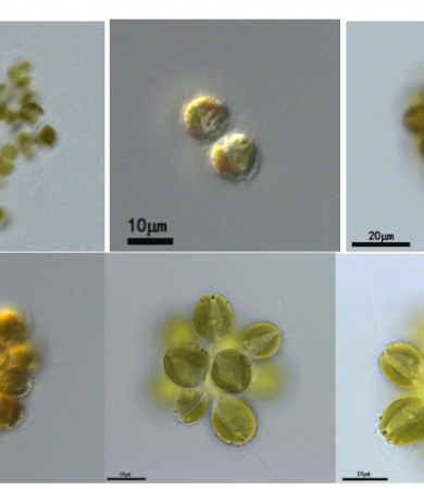 黄群藻 （GY-D11 Synura sp.）