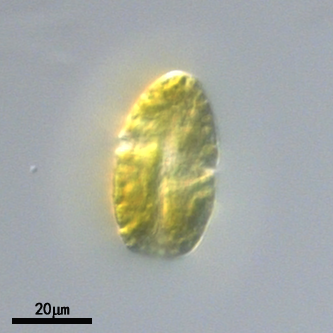GY-H65 链状裸甲藻 Gymnodinium catenatum
