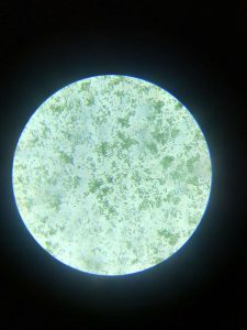 稀释100倍小球藻浓缩液显微镜照片
