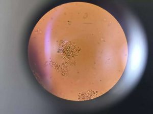 败坏的小球藻显微镜细胞图
