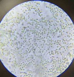 正常的小球藻显微镜细胞图