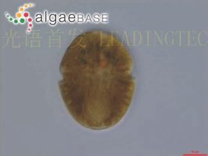 图18.裸甲藻（Gymnodinium uberrimum） (AlgaeBase Image Reference: 22537）