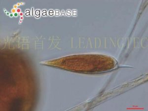 图19. 纤细原甲藻 (Prorocentrum gracile) ( AlgaeBase Image Reference: 10643）