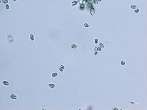 普林斯顿大学的研究人员已经发现了光合隐芽藻类强大的集光秘密。
