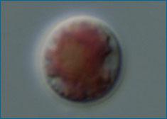 图2.放大的紫球藻细胞 （引自http://evolution.berkeley.edu/evolibrary/images/porphyridium.jpg）