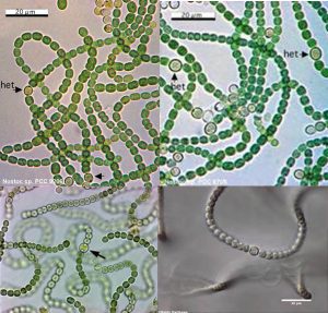 图10. 念珠藻的细胞形态
