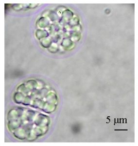 图12. Aurantiochytrium limacinum（不知道中文叫什么，可以看到细胞里一个个油滴，by Abad &Turon, 2015）