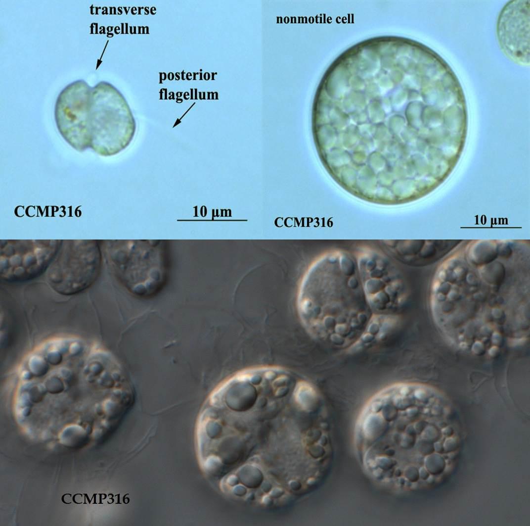 图17.寇氏隐甲藻CCMP316株，左上图细胞带着鞭毛，右上图是积累了油脂之后的形态，这个藻种是目前DHA藻油的主力生产藻种之一（要买这藻种找老倪）。