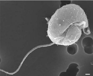 图18.是寇氏隐甲藻的电镜照片，能看到俩鞭毛。