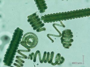 图2. 取自缅甸Twyn Taung湖中的如弹簧样的天然螺旋藻细胞，光学显微镜下可见有“紧缩”与“松散”两种螺旋细胞群类型，在养殖生产中，在营养等条件比较适宜的情况下，以出现“松散”型细胞群为主，“紧缩”型长度较短，不容易被过滤采收，在循环养殖的过程中，水体中会越积越多，为生产所“嫌弃”。