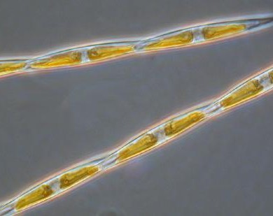 其实减肥没有那么难,菱形藻会给你惊喜!