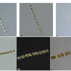 中肋骨条藻( GY-H69Skeletonema costatum)