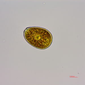 利玛原甲藻（GY-H57 Prorocentrum lima）