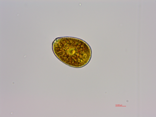 利玛原甲藻（GY-H57 Prorocentrum lima）