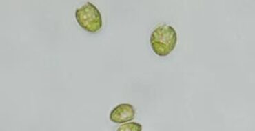 Three green oval algal cells visible on a pale background, magnified about 1000x; scale bar indicates 10 μm.