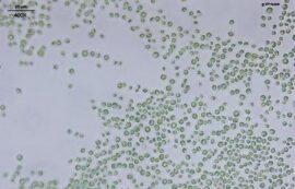 Under a light microscope at 400x magnification, numerous small green spherical algal cells are scattered across a pale background, suggesting a sample of single-celled green algae such as Chlorella.