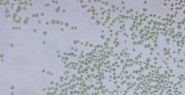 Under a light microscope at 400x magnification, numerous small green spherical algal cells are scattered across a pale background, suggesting a sample of single-celled green algae such as Chlorella.