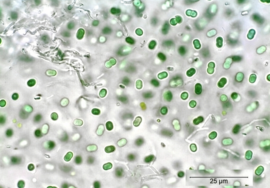 Fluorescent micrograph showing numerous green oval bacterial cells scattered on a light background; scale bar indicates 25 µm.