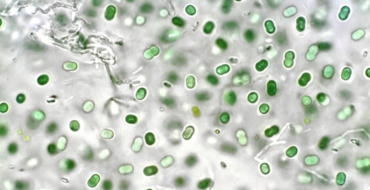 Fluorescent micrograph showing numerous green oval bacterial cells scattered on a light background; scale bar indicates 25 µm.