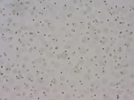 Light-mield micrograph showing many small, round cells dispersed in a pale background, likely yeast or similar microorganisms in suspension.