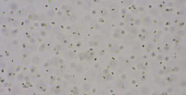 Light-mield micrograph showing many small, round cells dispersed in a pale background, likely yeast or similar microorganisms in suspension.