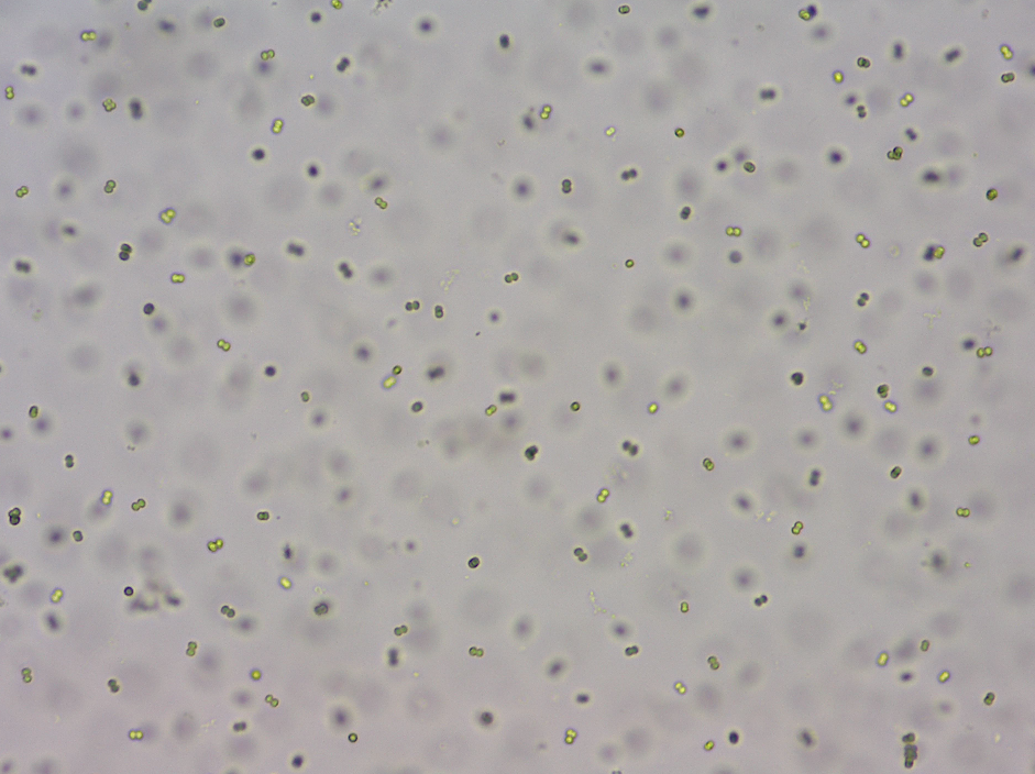 Light-mield micrograph showing many small, round cells dispersed in a pale background, likely yeast or similar microorganisms in suspension.