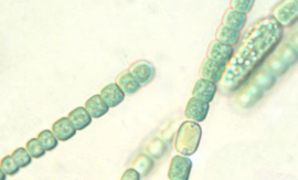 Close-up micrograph of filamentous green cyanobacteria cells in chain-like formations.